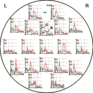 LSS-73-2000_008.gif