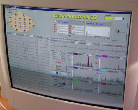 Microsleeps_obr2.jpg